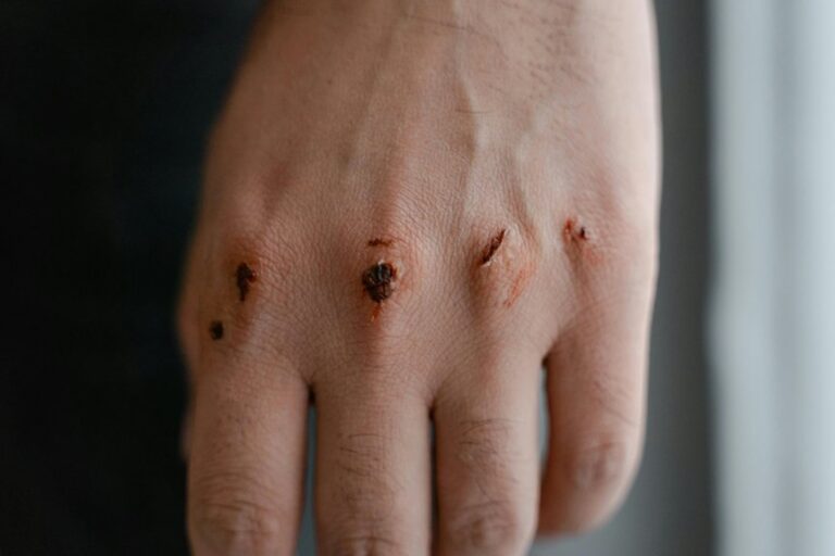 taser permanent damage risk